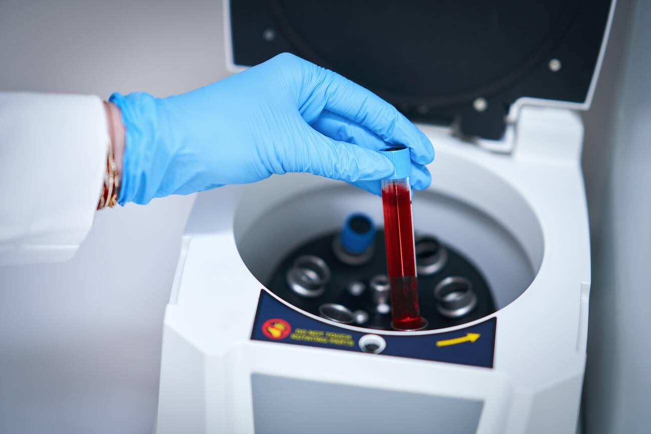 At-home blood test collection kit and an itemized price sheet laid out on a desk